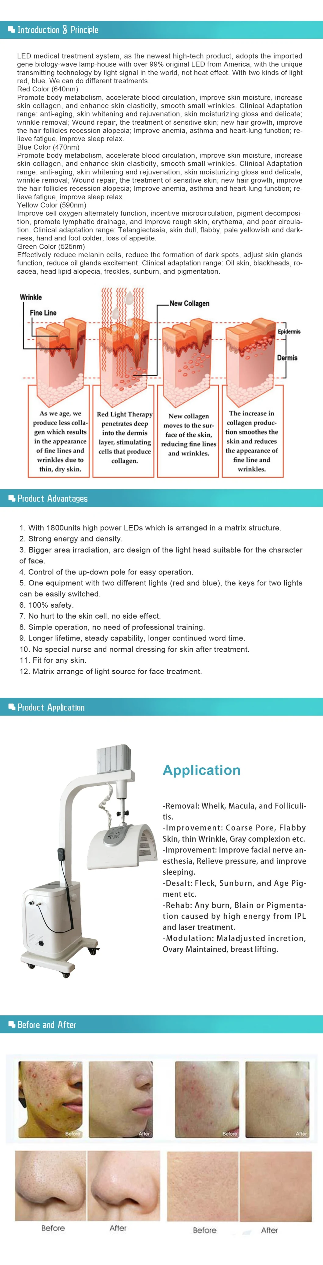 Medical Ce Approved Medical LED Light Therapy/ PDT LED Blue Red Green Light